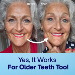 how to use dentist-approved whitening powder for stains