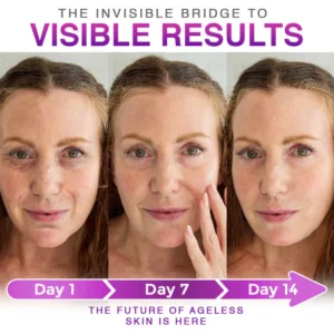 carebreeze 3-in-1 microneedle anti-aging patch for results