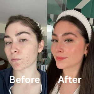 wake up to skin they finally recognize again results