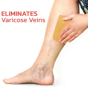 how to apply gfouk veinless patch for varicose veins