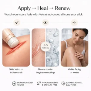 vetra scar stick before and after fading marks