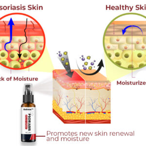anniecare psoriasis before and after flake reduction